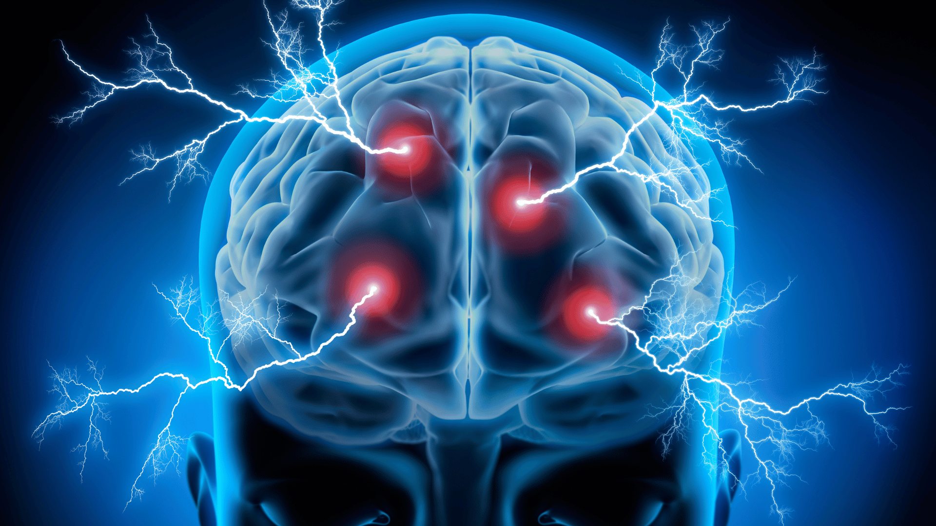 Scientific-like illustration of electrical currents entering a person's brain through several ports
